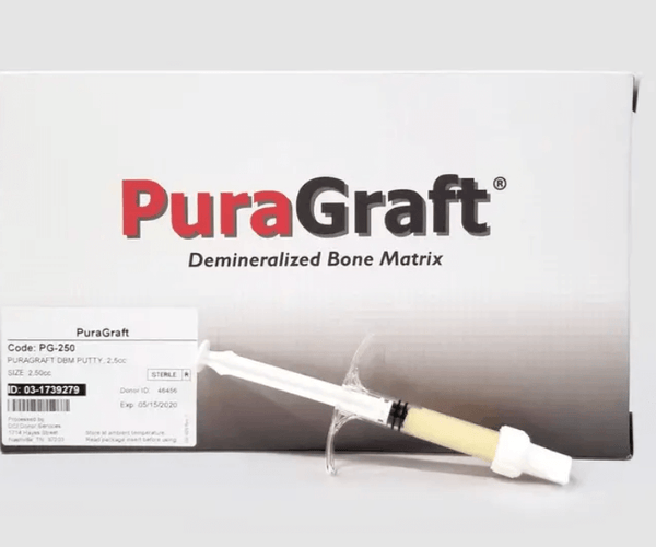 Demineralized Bone Matrix Solutions
