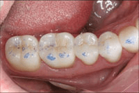 Bausch Articulating Paper 610-BK-62