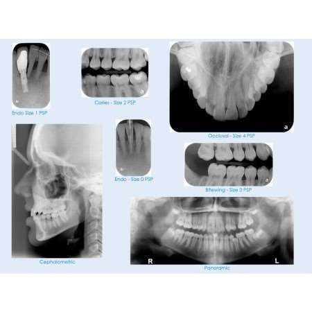 MARK3 | IntraOral Phosphor Imaging Plates by Mark3 | 100-7780