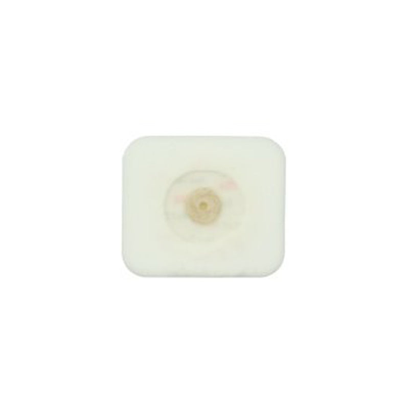 Monitoring Electrode, 1.60