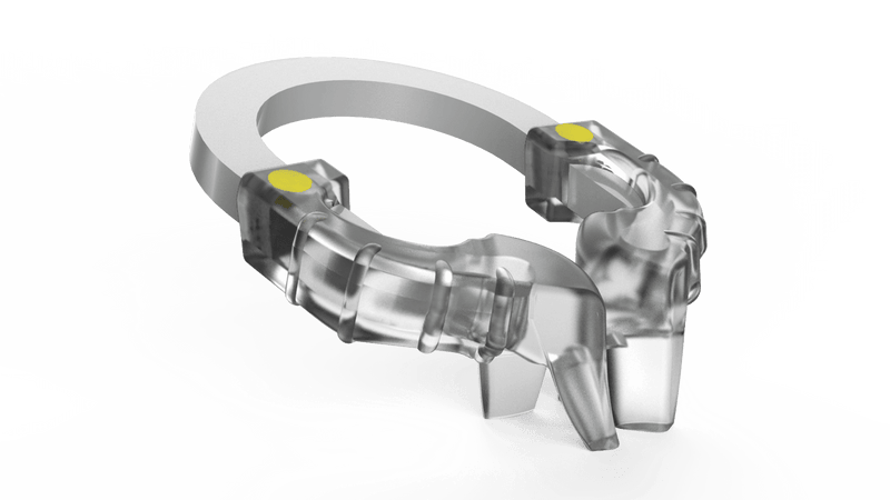 iMatrix Clear Ring Refill 2 x clear green standard rings | SurgiMac Dental Supply
