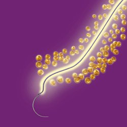 Coated Vicryl™ Plus Polyglactin 910 with Irgacare MP Antibacterial Suture PS-2 3/8 Circle Precision Reverse Cutting Needle Size 4-0 Braided | SurgiMac Dental Supply