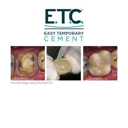 E.T.C. Easy Temporary Cement | S255 | | Cements, Dental, Dental Supplies, liners & adhesives, Temporary cement | Parkell | SurgiMac