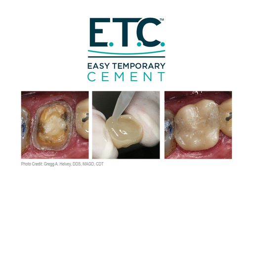 E.T.C. Easy Temporary Cement (1mL-Syringe) S255