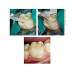 HF Bulk-Fill Composite Enamel Shade - A1/B1 (10mL) S323