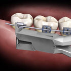 Hu-Friedy Slim Flush Cut and Hold Distal End Cutter, Long Handle | SurgiMac Dental Supply