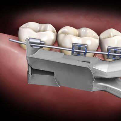 Hu-Friedy Slim Flush Cut and Hold Distal End Cutter, Long Handle | SurgiMac Dental Supply