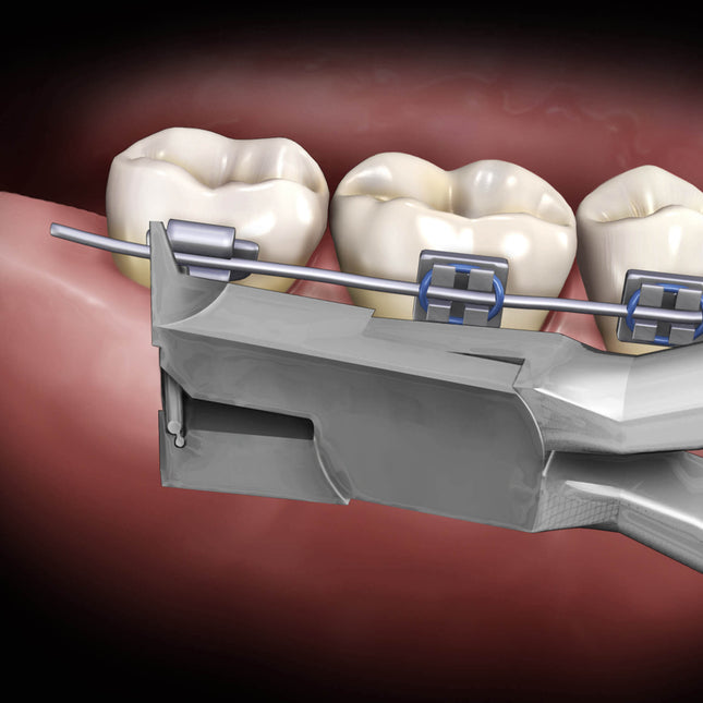 Hu-Friedy Blue Silicone O-Ring Replacement Pack for 678-114 (150 rings) | SurgiMac Dental Supply