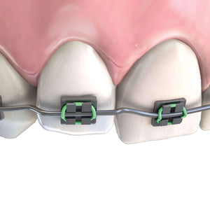 Hu-Friedy Step Pliers, 1 mm | SurgiMac Dental Supply