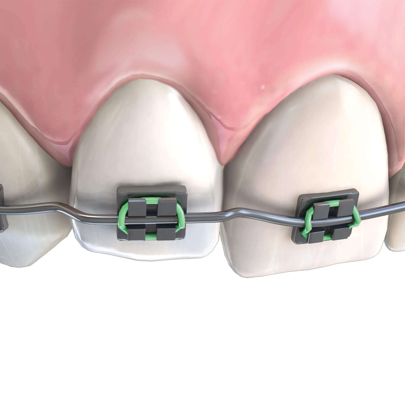 Hu-Friedy Step Pliers, 1 mm | SurgiMac Dental Supply