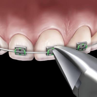 Hu-Friedy Slim Micro Cutter | SurgiMac Dental Supply