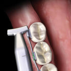 Hu-Friedy Slim Hammerhead™ NiTi Pliers | SurgiMac Dental Supply