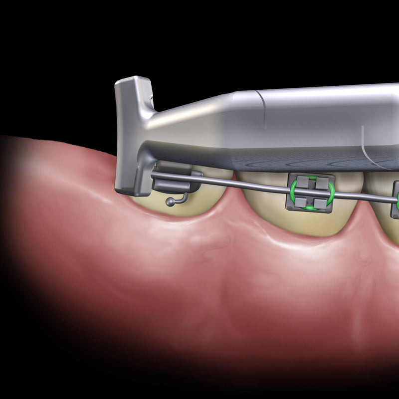 Hu-Friedy Slim Hammerhead™ NiTi Pliers | SurgiMac Dental Supply