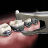 Hu-Friedy Slim Posterior Band Removing Pliers