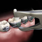 Hu-Friedy Slim Posterior Band Removing Pliers | SurgiMac Dental Supply