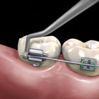 Hu-Friedy Distal Cinch Back Hand Instrument | SurgiMac Dental Supply