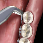 Hu-Friedy Lingual Distal End Cutter | SurgiMac Dental Supply