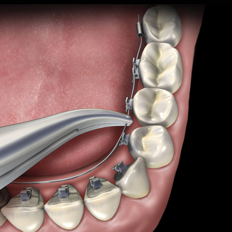 Hu-Friedy Lingual Weingart Pliers, 90 Degrees | SurgiMac Dental Supply