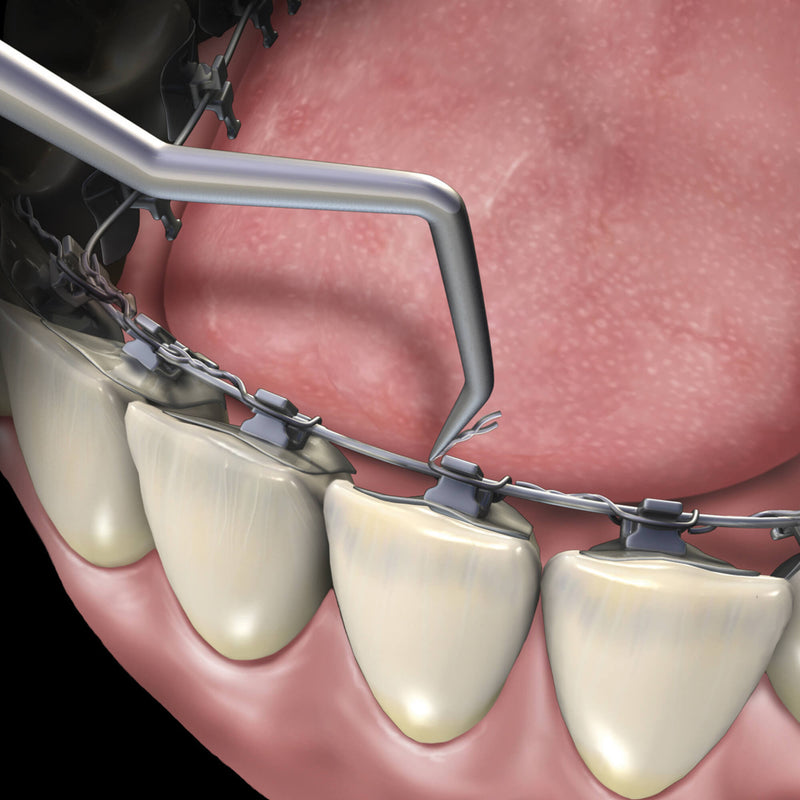 Hu-Friedy Lingual Ligature Director | SurgiMac Dental Supply