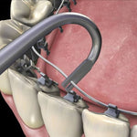 Hu-Friedy Lingual Ligature Director, U Shape | SurgiMac Dental Supply