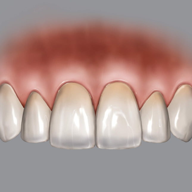 Hu-Friedy BLPG Replacement Tips (3 Tips) | SurgiMac Dental Supply