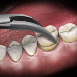 Hu-Friedy Temporary Crown Remover | SurgiMac Dental Supply