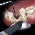 Hu-Friedy Retractor U of Minn. Black Line | SurgiMac Dental Supply