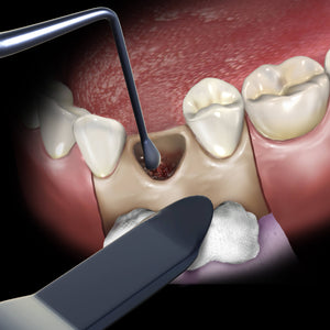 Hu-Friedy Retractor U of Minn. Black Line | SurgiMac Dental Supply