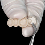 Hu-Friedy 7 Novatech™ Spatula and Blade | SurgiMac Dental Supply