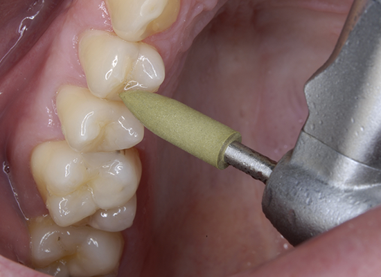 CompoMaster and CompoMaster Coarse 120C