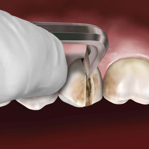 Hu-Friedy Goldstein Crown Remover, 90° | SurgiMac Dental Supply