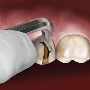 Hu-Friedy Goldstein Crown Remover, 90° | SurgiMac Dental Supply