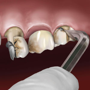 Hu-Friedy Goldstein Crown Remover, 90° | SurgiMac Dental Supply