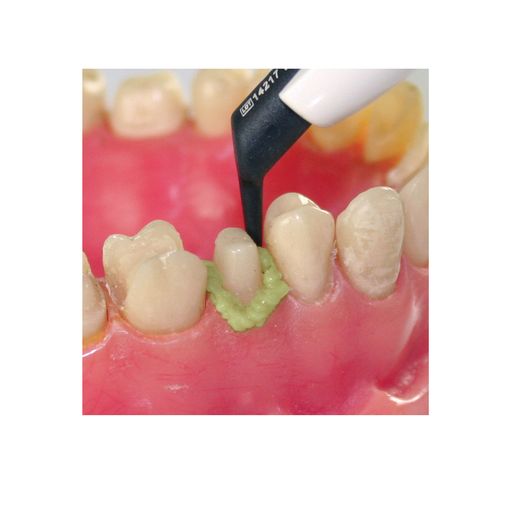 Dryz Gingival Hemostatic Retraction Paste unit dose capsule, 30 x 0.24 gram S183