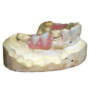 Itsoclear Clasps | SurgiMac Dental Supply