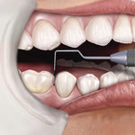 Hu-Friedy CP-11 Novatech Color-Coded Probe | SurgiMac Dental Supply