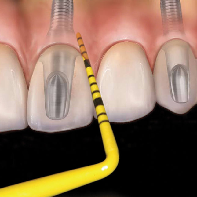 Hu-Friedy Williams Colorvue™ Probe Tips, 12 pack | SurgiMac Dental Supply