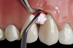 Hu-Friedy PM Split Periosteal, Short, Black Line | SurgiMac Dental Supply