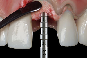Hu-Friedy PM Split Periosteal, Short, Black Line | SurgiMac Dental Supply