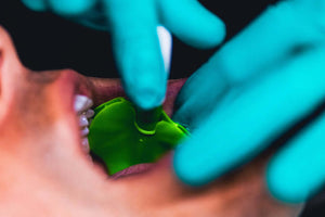 ReLeaf Suction Kit Green / Gray / White Ea | SurgiMac Dental Supply