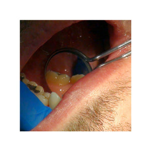 20/20 Double-Sided Mirrors by Parkell (6 pcs) S475