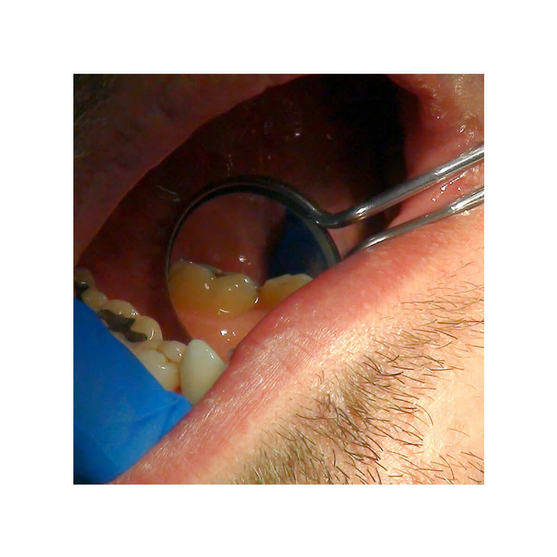 20/20 Double-Sided Mirrors by Parkell (6 pcs) S475