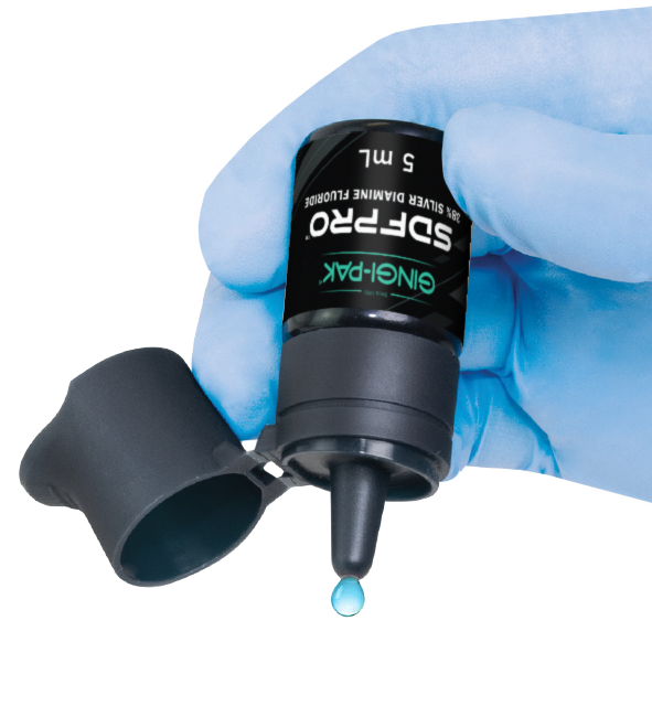 SDF Pro 5 mL Bottle Kit: 1x 5 mL Bottle, 50 x Micro Applicator Tips