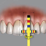Hu-Friedy T-Bar Replacement Tips (3 Tips) | SurgiMac Dental Supply
