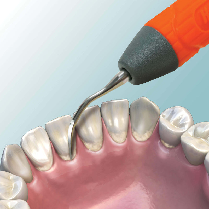 Hu-Friedy Swivel Direct Flow™ Insert, #1000 Triple Bend | SurgiMac Dental Supply
