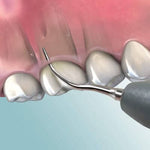 Hu-Friedy XT Triple Bend Insert | SurgiMac Dental Supply