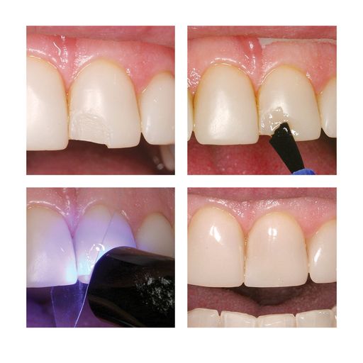 Add&Bond Adhesive Composite Primer S260