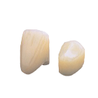House Brand #28 Upper Left Lateral Polycarbonate Crown Form, Box of 5 Crown
