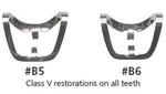 Brinker #B-6 All Bicuspids & Incisors Clamp (Tissue Retractor). Single Clamp | SurgiMac Dental Supply