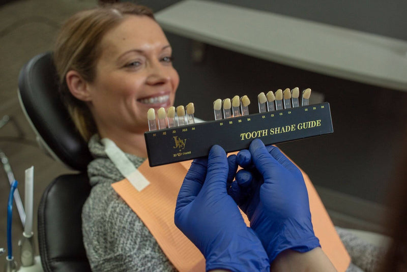 Joy Tooth Shade Guide | SurgiMac Dental Supply